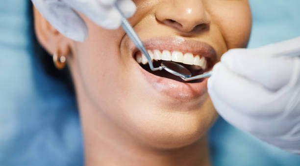 Best Emergency Tooth Extraction in Madison, NE